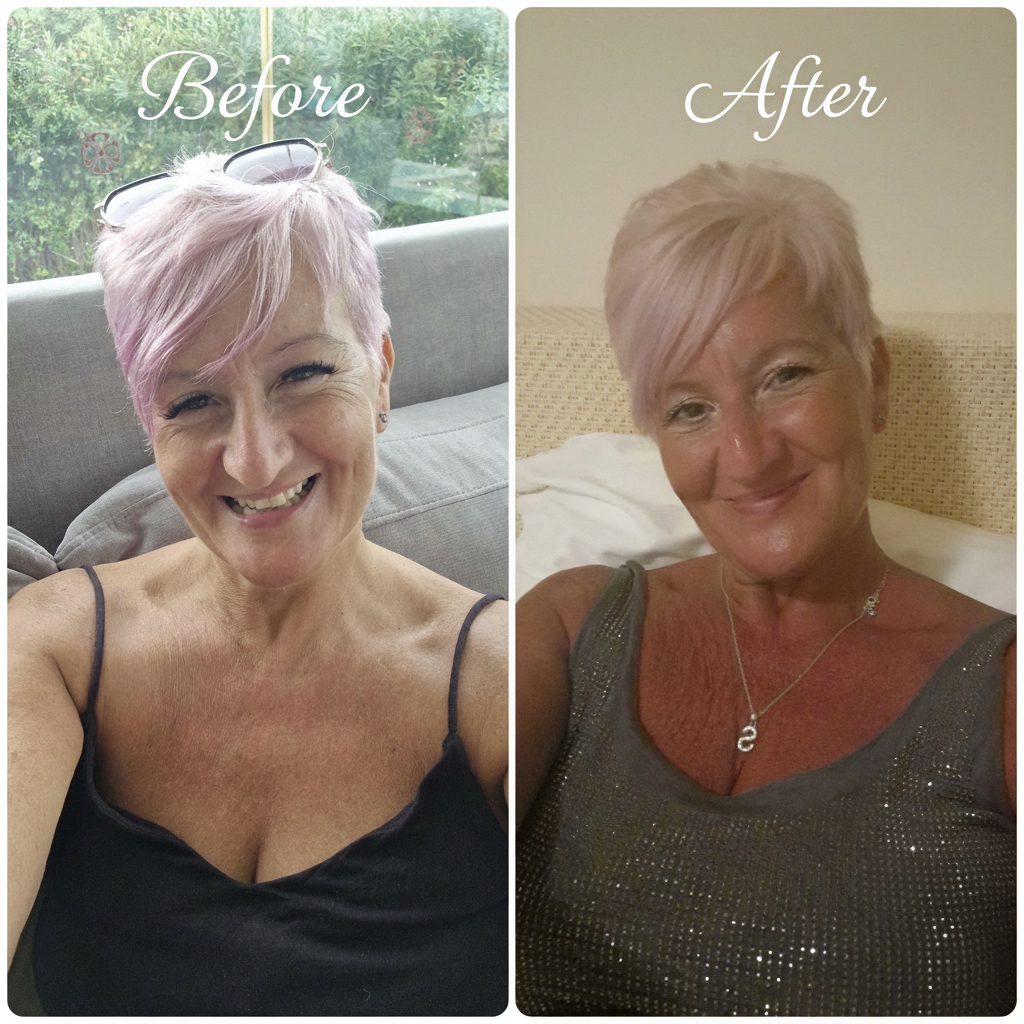 Before and After